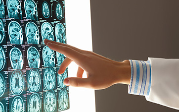 What Are the Different Types of Brain Cancer